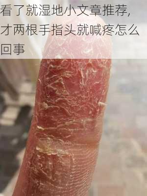 看了就湿地小文章推荐,才两根手指头就喊疼怎么回事-第2张图片-二喜范文网